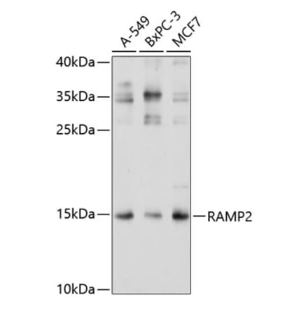 Western Blot - Anti-RAMP2 Antibody (A11605) - Antibodies.com