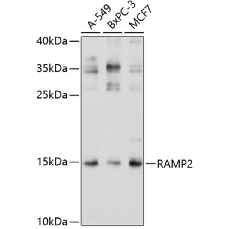 Western Blot - Anti-RAMP2 Antibody (A11605) - Antibodies.com