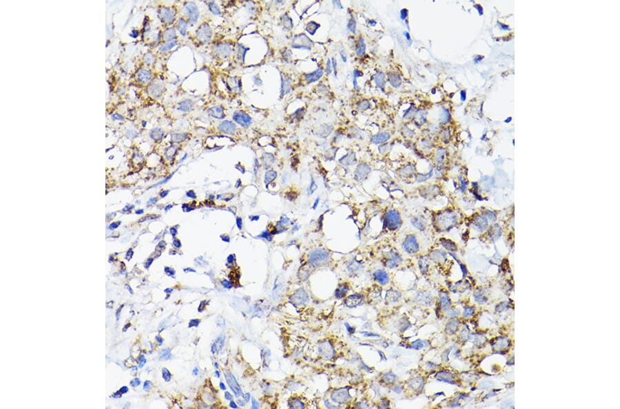 Immunohistochemistry - Anti-RAMP2 Antibody (A11605) - Antibodies.com