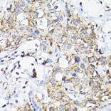 Immunohistochemistry - Anti-RAMP2 Antibody (A11605) - Antibodies.com