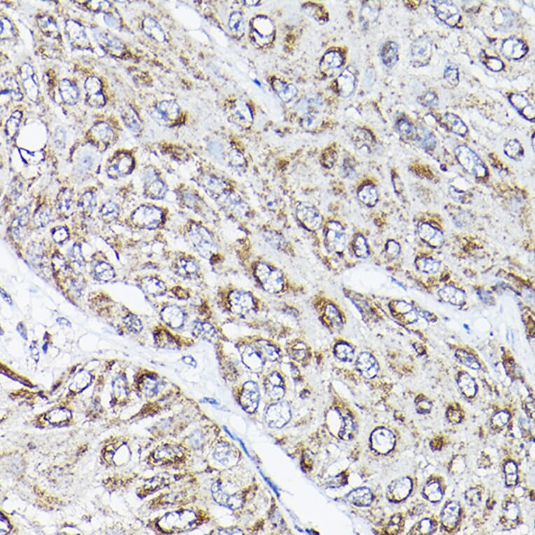 Immunohistochemistry - Anti-RAMP2 Antibody (A11605) - Antibodies.com