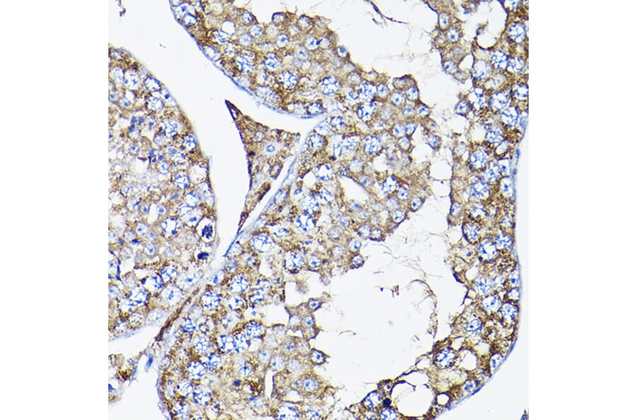 Immunohistochemistry - Anti-RAMP2 Antibody (A11605) - Antibodies.com