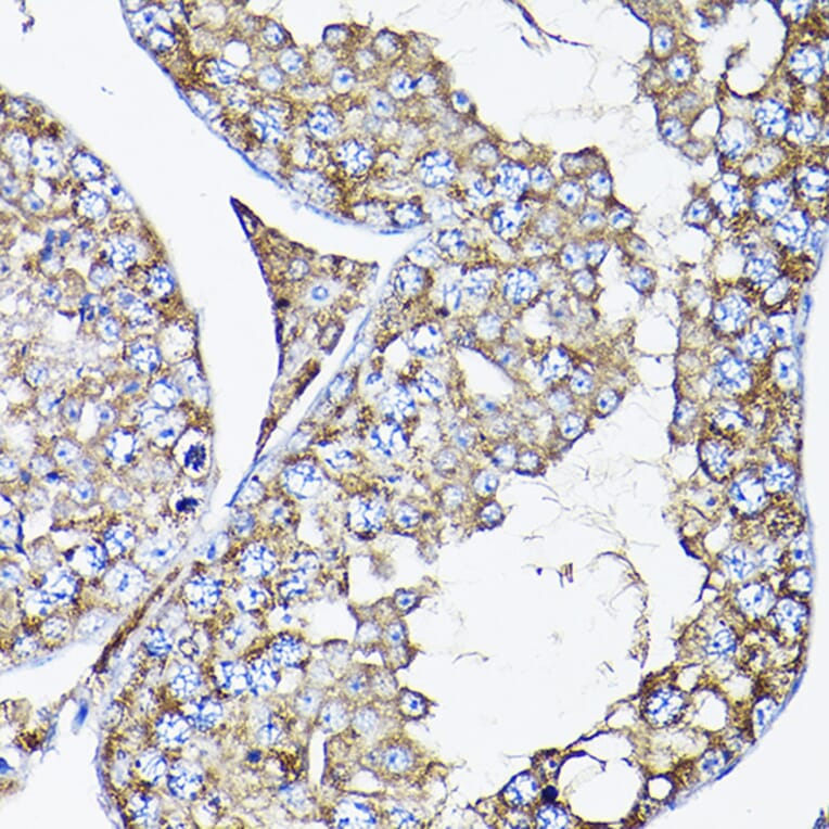 Immunohistochemistry - Anti-RAMP2 Antibody (A11605) - Antibodies.com