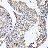 Immunohistochemistry - Anti-RAMP2 Antibody (A11605) - Antibodies.com