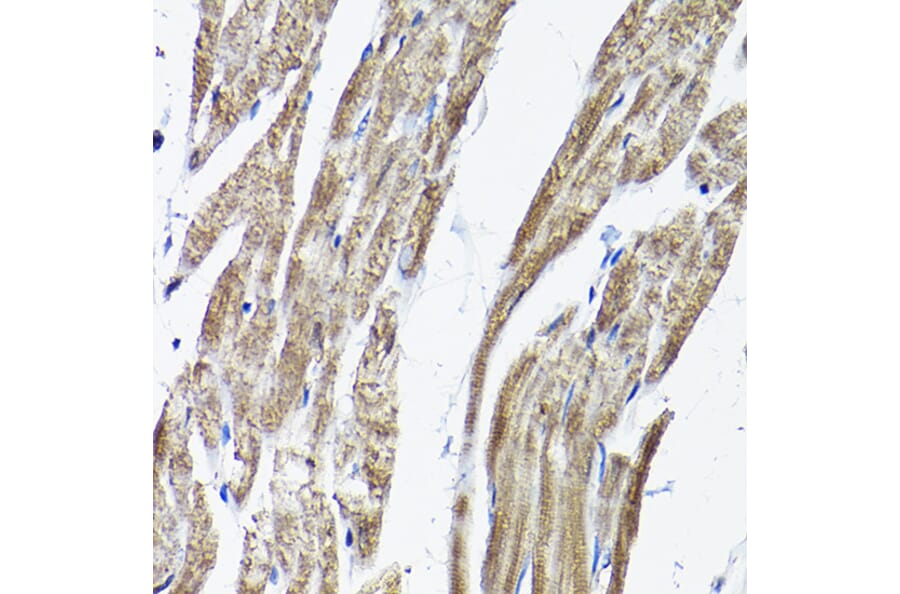 Immunohistochemistry - Anti-RAMP2 Antibody (A11605) - Antibodies.com
