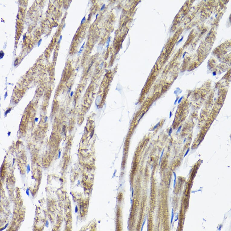 Immunohistochemistry - Anti-RAMP2 Antibody (A11605) - Antibodies.com