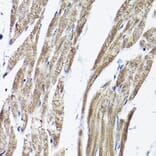 Immunohistochemistry - Anti-RAMP2 Antibody (A11605) - Antibodies.com