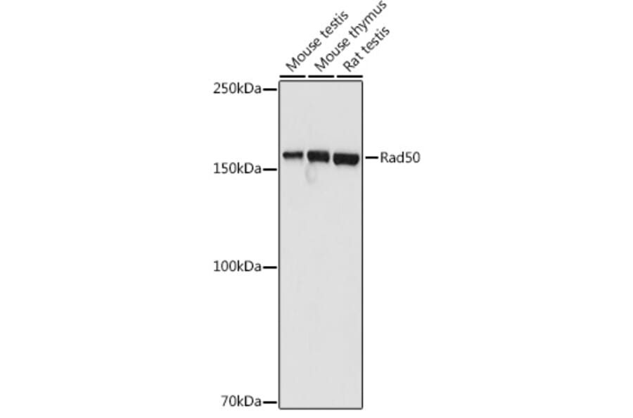 Western Blot - Anti-Rad50 Antibody (A11606) - Antibodies.com