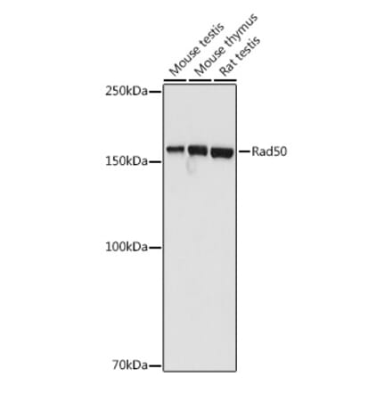 Western Blot - Anti-Rad50 Antibody (A11606) - Antibodies.com