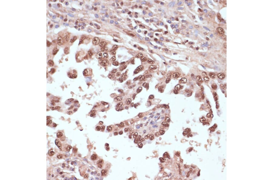 Immunohistochemistry - Anti-Rad50 Antibody (A11606) - Antibodies.com