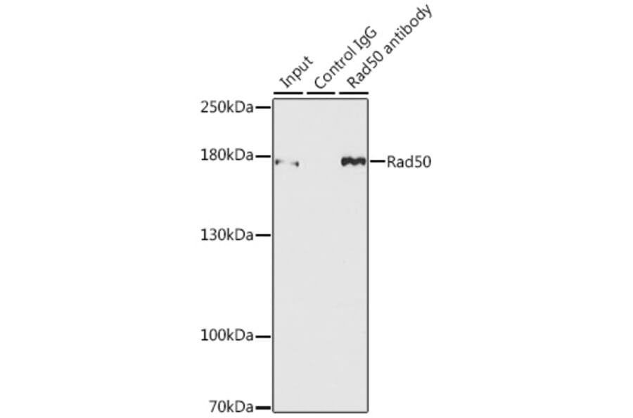 Western Blot - Anti-Rad50 Antibody (A11606) - Antibodies.com