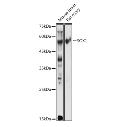 Western Blot - Anti-SOX1 Antibody (A11607) - Antibodies.com