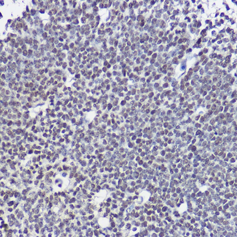 Immunohistochemistry - Anti-SOX1 Antibody (A11607) - Antibodies.com