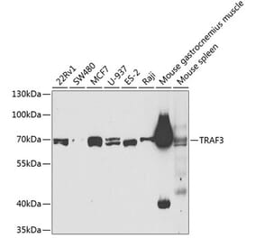 Western Blot - Anti-TRAF3 Antibody (A11608) - Antibodies.com