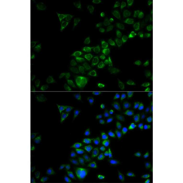 Immunofluorescence - Anti-TRAF3 Antibody (A11608) - Antibodies.com