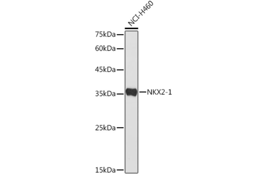 Western Blot - Anti-TTF1 Antibody (A11609) - Antibodies.com