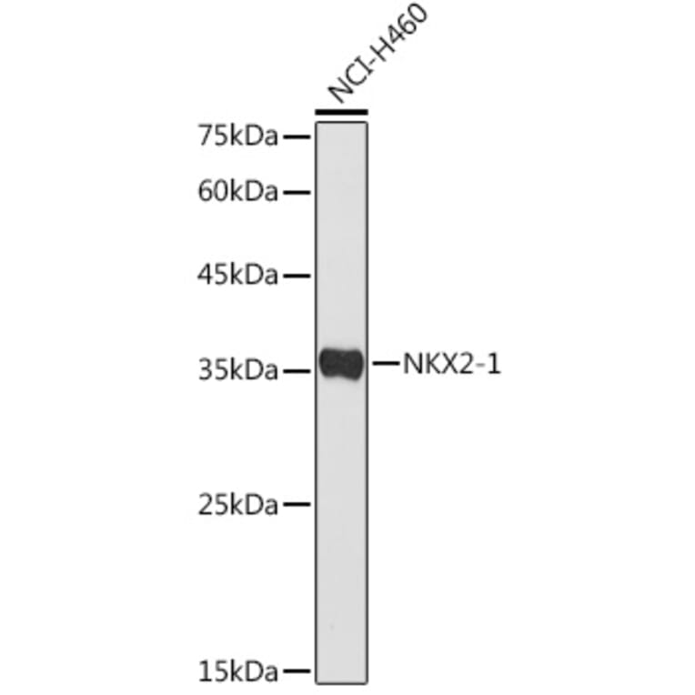 Western Blot - Anti-TTF1 Antibody (A11609) - Antibodies.com