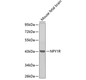 Western Blot - Anti-NPY1R Antibody (A11611) - Antibodies.com
