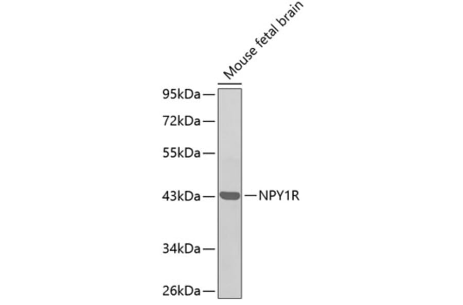 Western Blot - Anti-NPY1R Antibody (A11611) - Antibodies.com