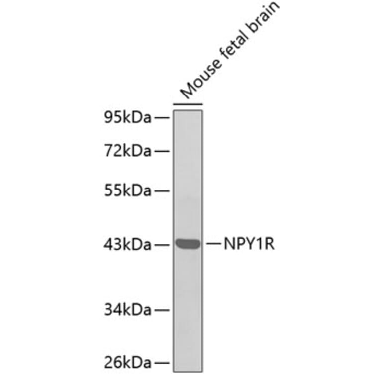 Western Blot - Anti-NPY1R Antibody (A11611) - Antibodies.com