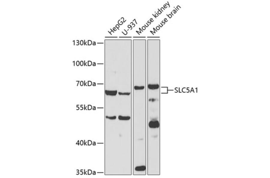 Western Blot - Anti-SLC5A1 Antibody (A3126) - Antibodies.com