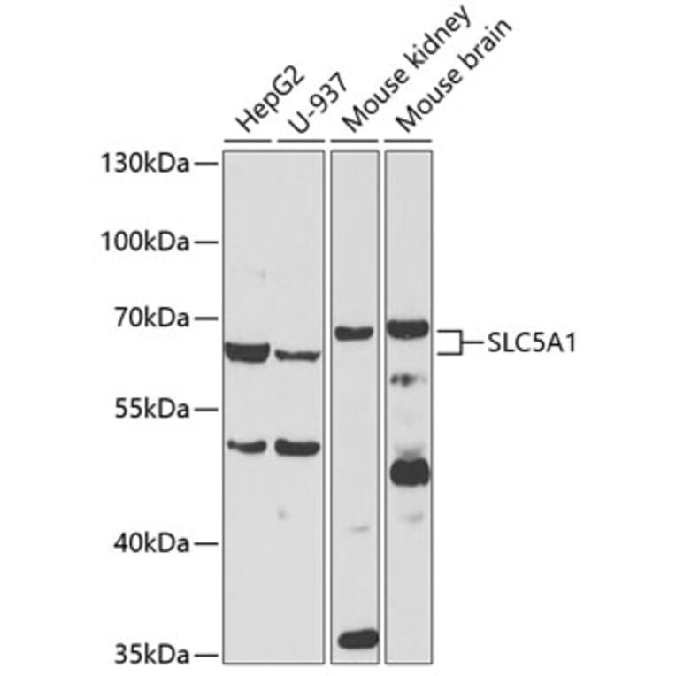 Western Blot - Anti-SLC5A1 Antibody (A3126) - Antibodies.com