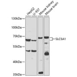 Western Blot - Anti-SLC5A1 Antibody (A3126) - Antibodies.com