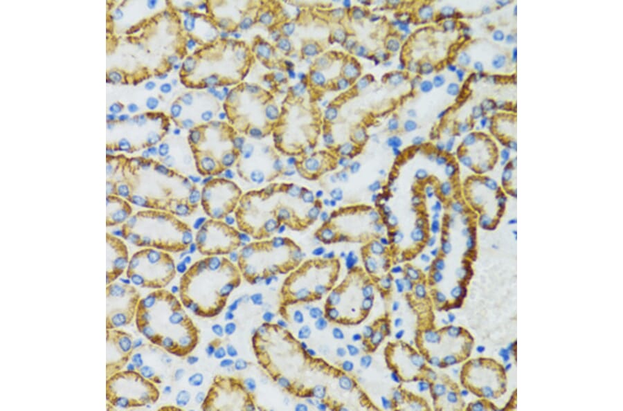 Immunohistochemistry - Anti-SLC5A1 Antibody (A3126) - Antibodies.com