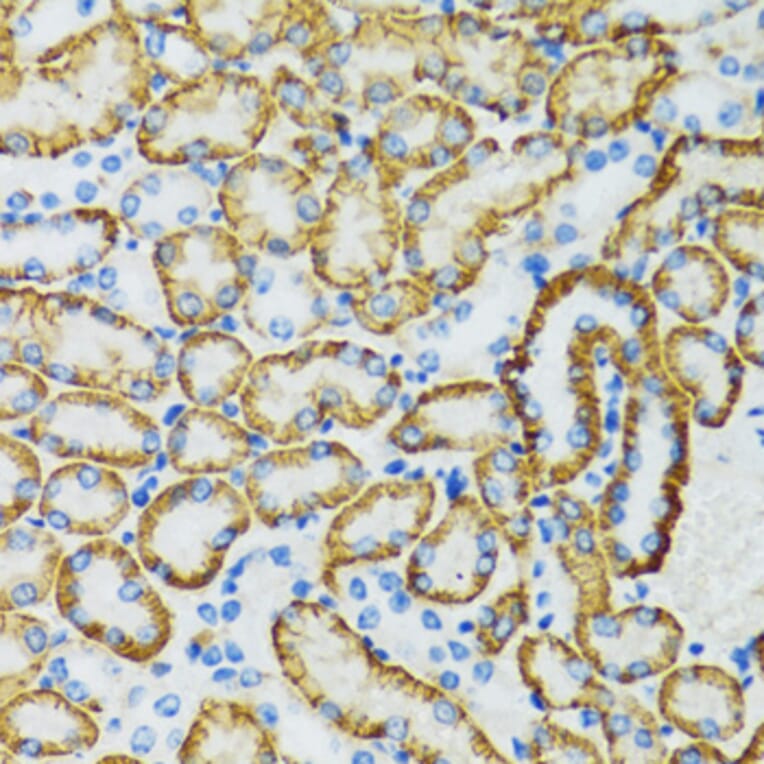 Immunohistochemistry - Anti-SLC5A1 Antibody (A3126) - Antibodies.com