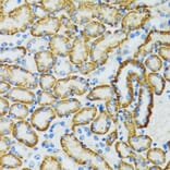 Immunohistochemistry - Anti-SLC5A1 Antibody (A3126) - Antibodies.com