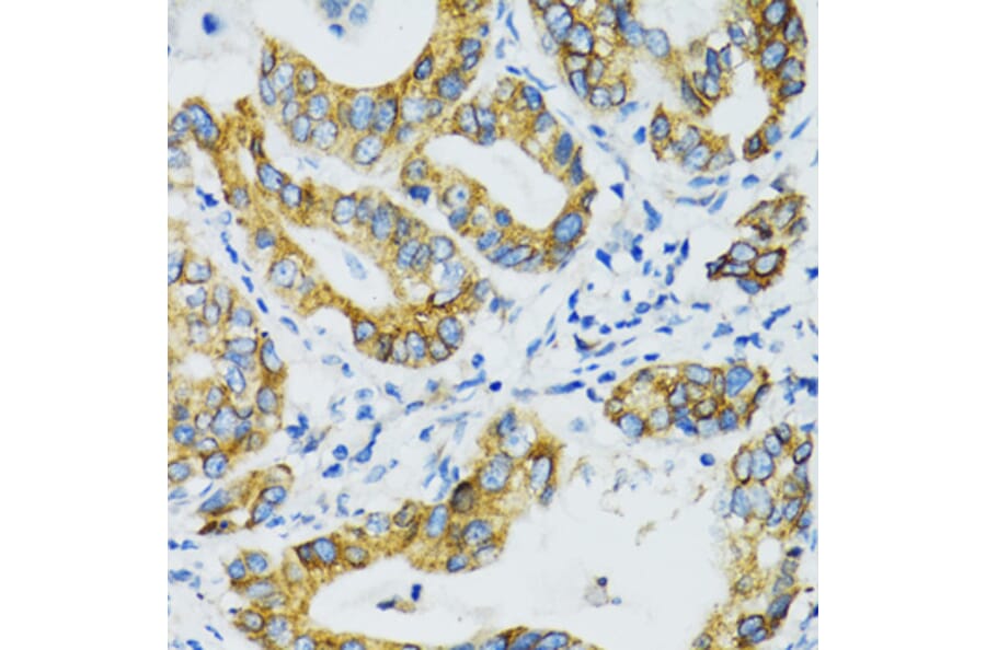 Immunohistochemistry - Anti-SLC5A1 Antibody (A3126) - Antibodies.com
