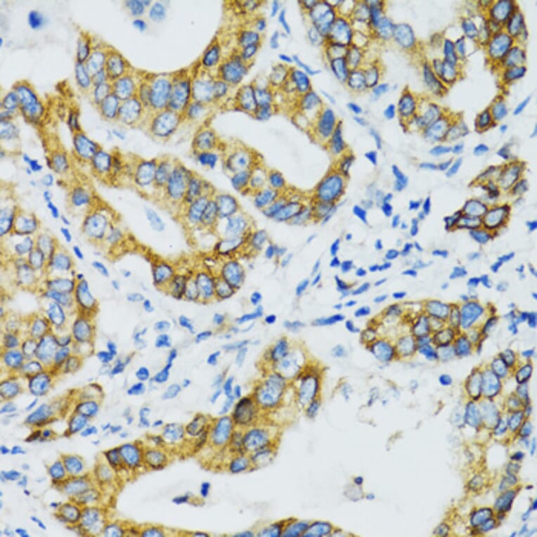 Immunohistochemistry - Anti-SLC5A1 Antibody (A3126) - Antibodies.com