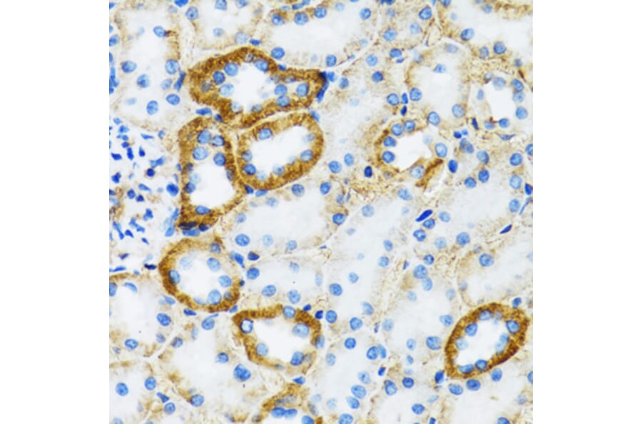 Immunohistochemistry - Anti-SLC5A1 Antibody (A3126) - Antibodies.com