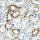 Immunohistochemistry - Anti-SLC5A1 Antibody (A3126) - Antibodies.com