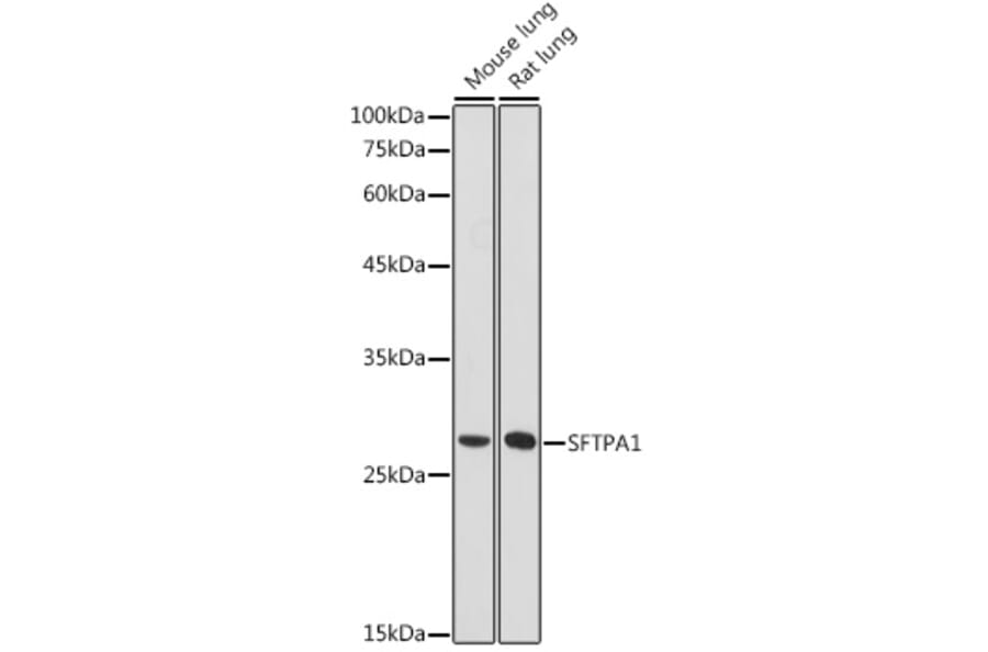 Western Blot - Anti-Surfactant Protein A/PSAP Antibody (A11614) - Antibodies.com