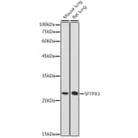 Western Blot - Anti-Surfactant Protein A/PSAP Antibody (A11614) - Antibodies.com