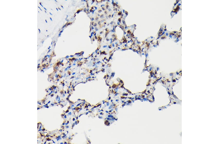 Immunohistochemistry - Anti-Surfactant Protein A/PSAP Antibody (A11614) - Antibodies.com