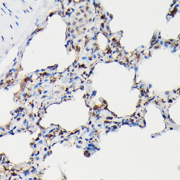 Immunohistochemistry - Anti-Surfactant Protein A/PSAP Antibody (A11614) - Antibodies.com