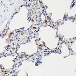 Immunohistochemistry - Anti-Surfactant Protein A/PSAP Antibody (A11614) - Antibodies.com