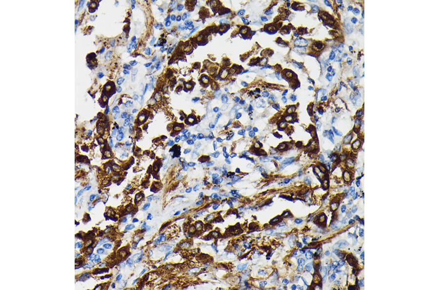 Immunohistochemistry - Anti-Surfactant Protein A/PSAP Antibody (A11614) - Antibodies.com