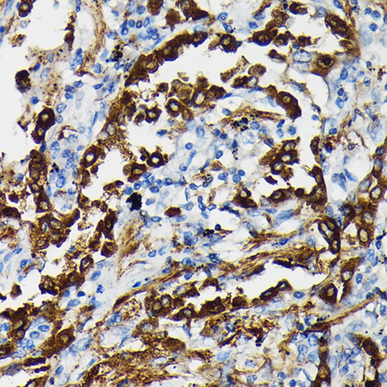 Immunohistochemistry - Anti-Surfactant Protein A/PSAP Antibody (A11614) - Antibodies.com