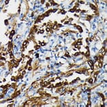 Immunohistochemistry - Anti-Surfactant Protein A/PSAP Antibody (A11614) - Antibodies.com