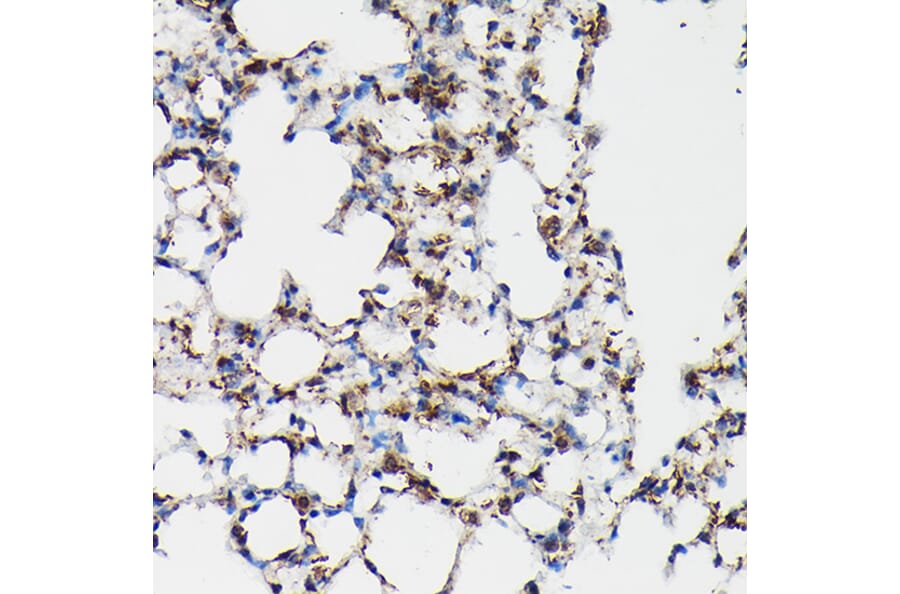 Immunohistochemistry - Anti-Surfactant Protein A/PSAP Antibody (A11614) - Antibodies.com