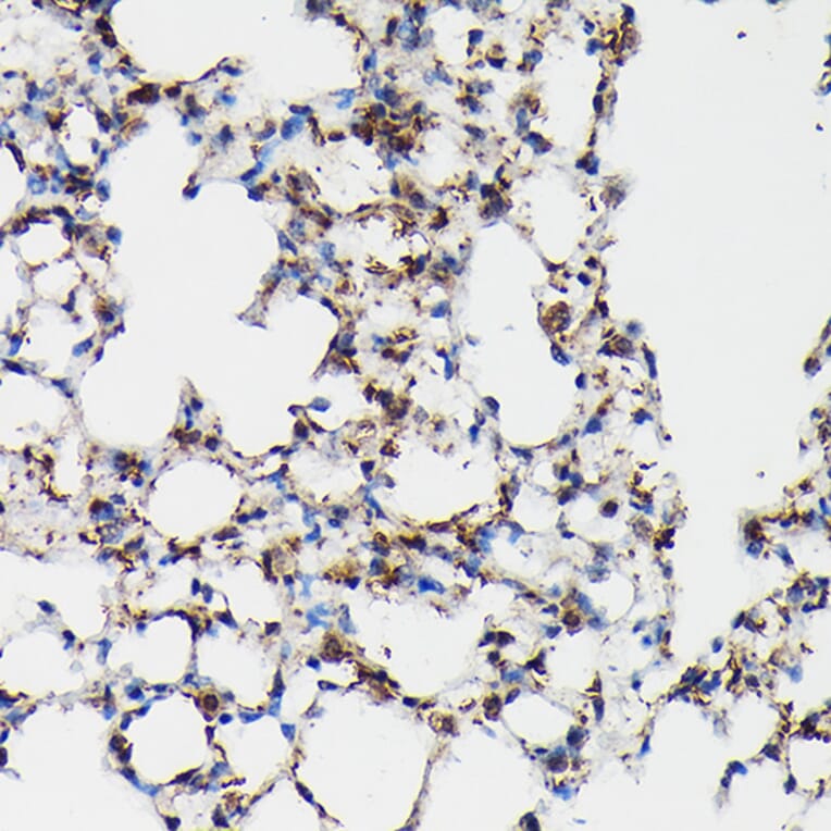 Immunohistochemistry - Anti-Surfactant Protein A/PSAP Antibody (A11614) - Antibodies.com