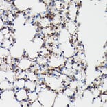 Immunohistochemistry - Anti-Surfactant Protein A/PSAP Antibody (A11614) - Antibodies.com