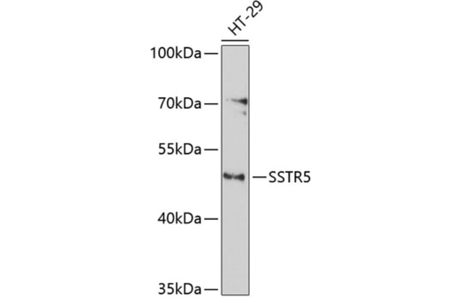 Western Blot - Anti-SSTR5 Antibody (A3136) - Antibodies.com