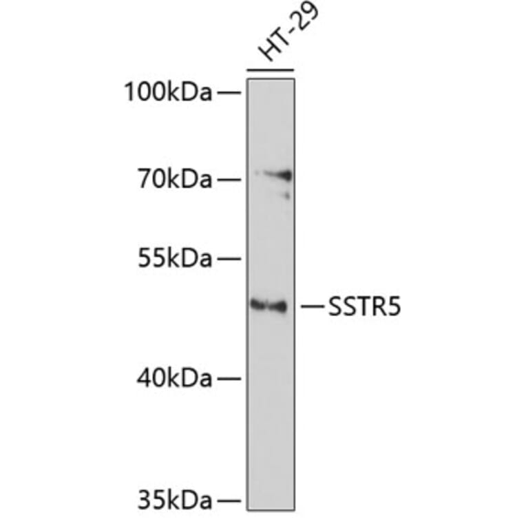 Western Blot - Anti-SSTR5 Antibody (A3136) - Antibodies.com
