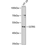 Western Blot - Anti-SSTR5 Antibody (A3136) - Antibodies.com