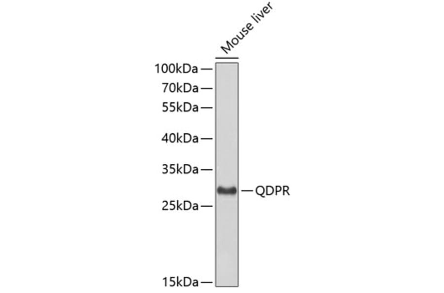 Western Blot - Anti-QDPR Antibody (A3150) - Antibodies.com