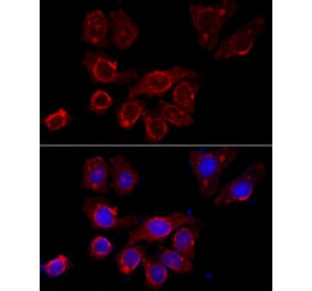 Immunofluorescence - Anti-CD116 Antibody (A11617) - Antibodies.com